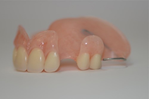 Korean Dentures East Otis MA 1029